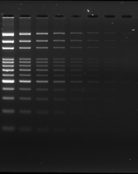 DNA/RNA Electrophoresis