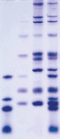 Protein Electrophoresis